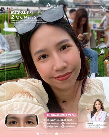 หน้าเต็ม-ฟิว-2เดือน