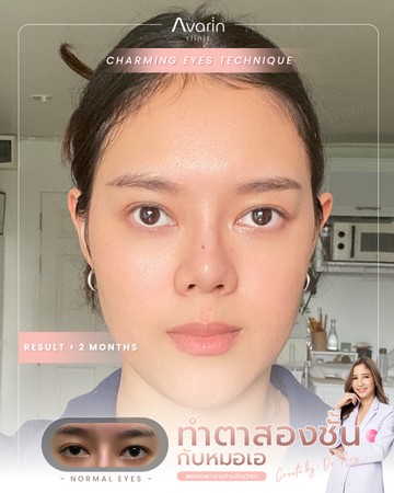 หน้าเต็ม-มุ้บจู-2เดือน