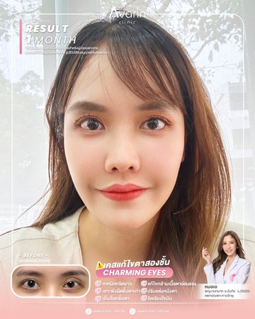 หน้าเต็ม-หมูแดง-1เดือน