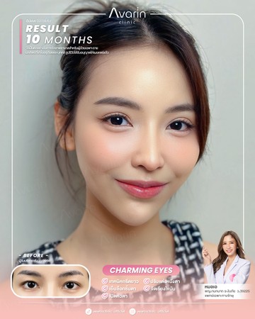หน้าเต็ม-อชิ10เดือน