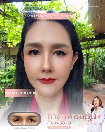 หน้าเต็ม-อุ๊-8เดือน
