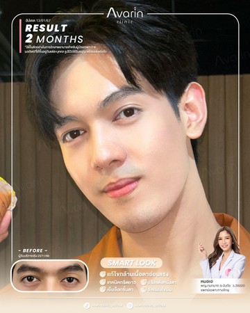 หน้าเต็ม-เจ้น-2เดือน