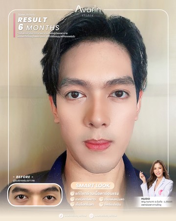 หน้าเต็ม-เจ้น-6เดือน