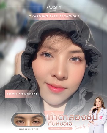 หน้าเต็ม-เนย์-6เดือน