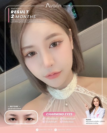 หน้าเต็ม-เบลล่า-2เดือน