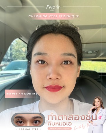หน้าเต็ม-เมย์-4เดือน