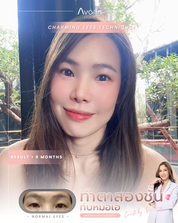 หน้าเต็ม-แคท-9เดือน
