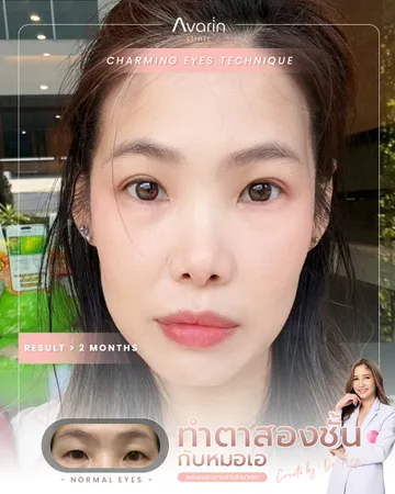 หน้าเต็ม-แคท