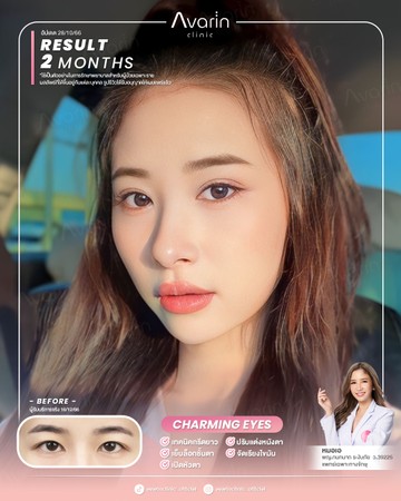 หน้าเต็ม-แนน-2เดือน
