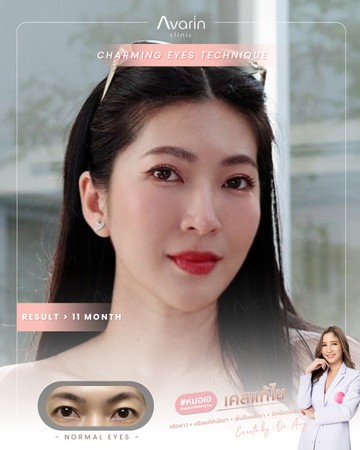 หน้าเต็ม-แป้งแก้ตัด-11เดือน