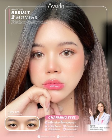 หน้าเต็ม-แอ๋ม-ใหม่-2เดือน