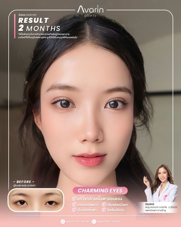 หน้าเต็ม-ใหม่-2เดือน