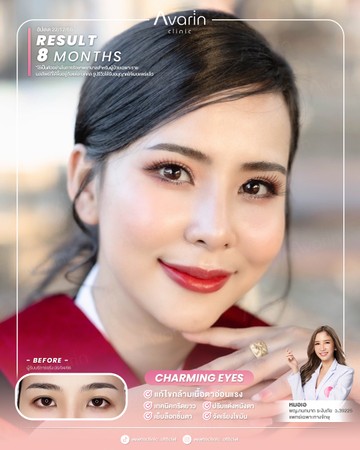 หน้าเต็มใหม่-ตอง-8เดือน