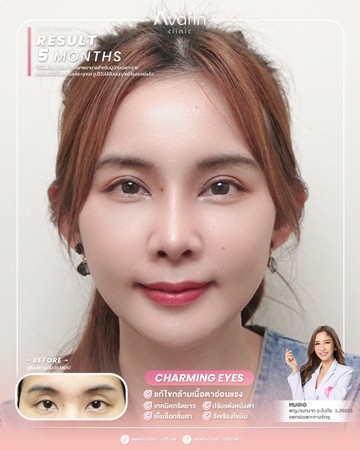 หน้าเต็มใหม่-นุช-4เดือน