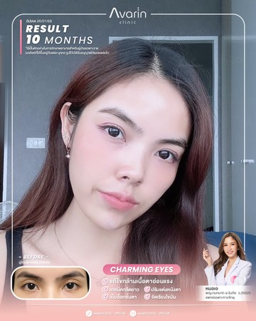 หน้าเต็มใหม่-หลิง-10เดือน