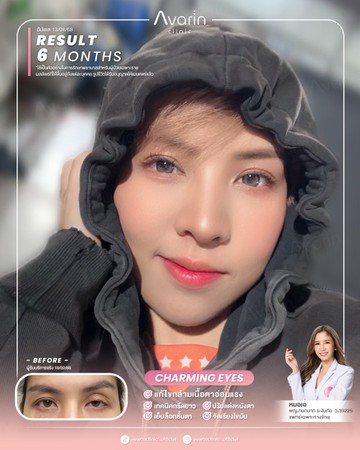 หน้าเต็มใหม่-เนย์-6เดือน