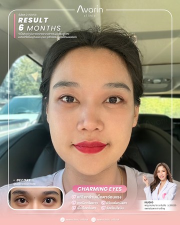หน้าเต็มใหม่-เมย์-6เดือน