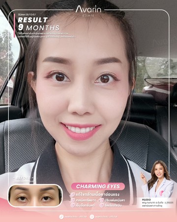 หน้าเต็มใหม่-เมย์-9เดือน