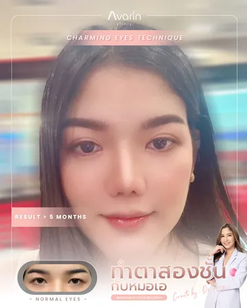 อันนา
