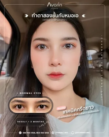 เพิ่มตัด1