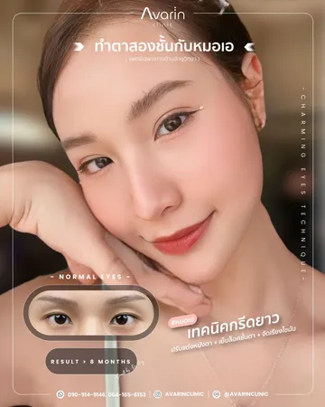 เพิ่มตัด2