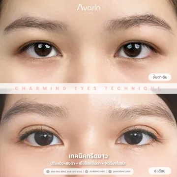 เรนนี่-6เดือน-1024x1024