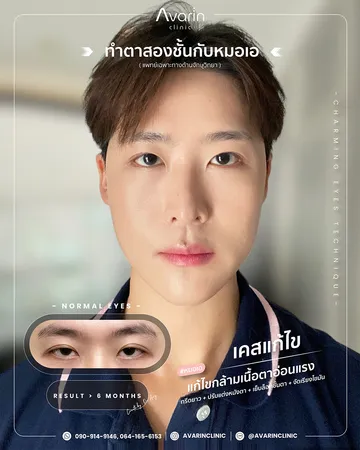 แก้คุณเพชร