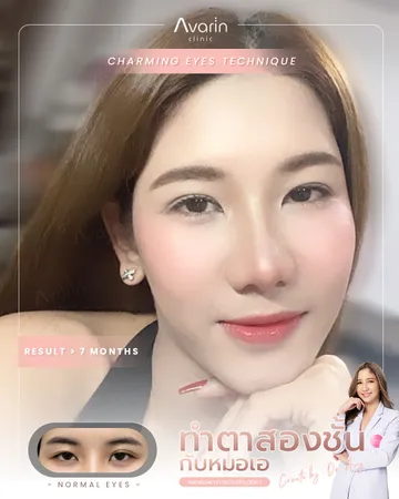 แก้ตก