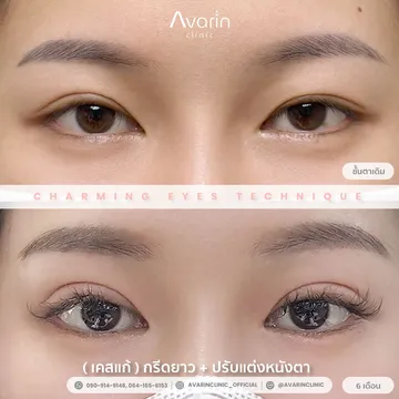 แก้ตัด