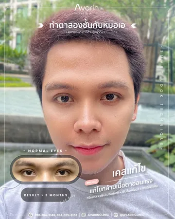 แก้รีวิวคุณบีม