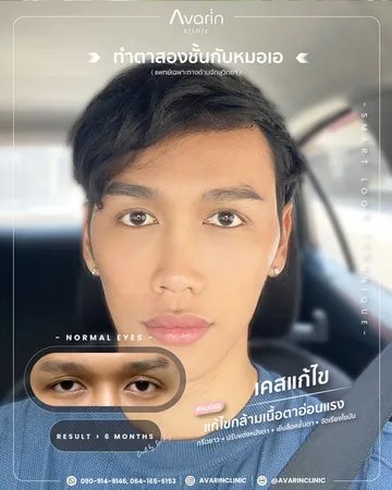 แก้เต็ม