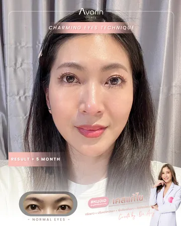 แป้งแก้ตัด