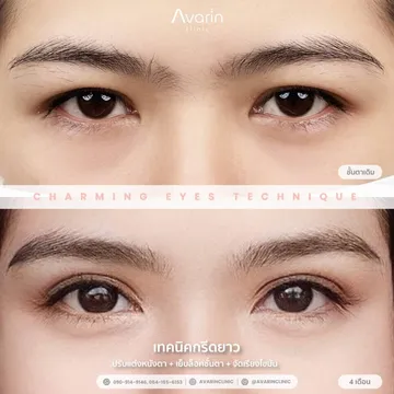 โอ๋-4เดือน-1024x1024