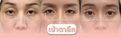 ก่อนทำ(1)