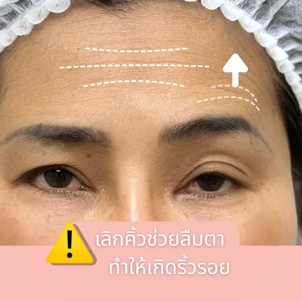 บัดบังการมองเห็น(1)