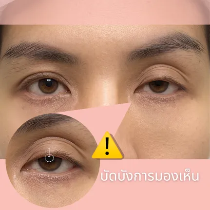 บัดบังการมองเห็น