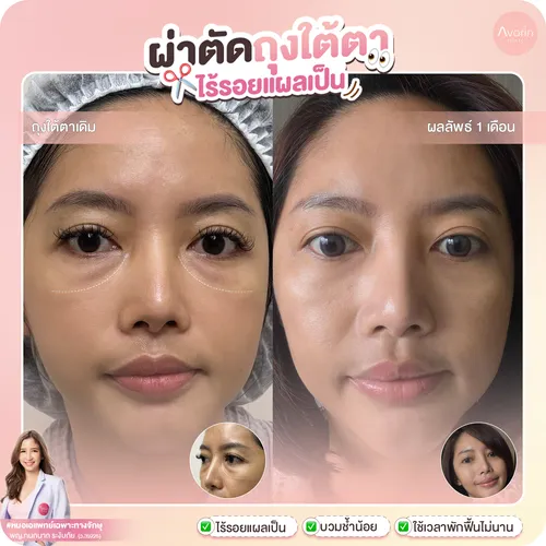 กลม