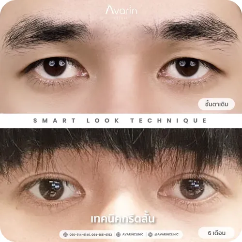ดีไซน์ที่ยังไม่ได้ตั้งชื่อ