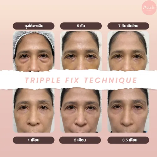 ไทม์ไลน์