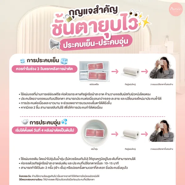 การประคบ