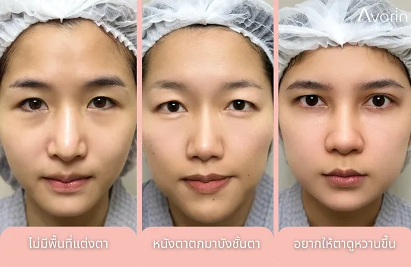 ก่อนทำ