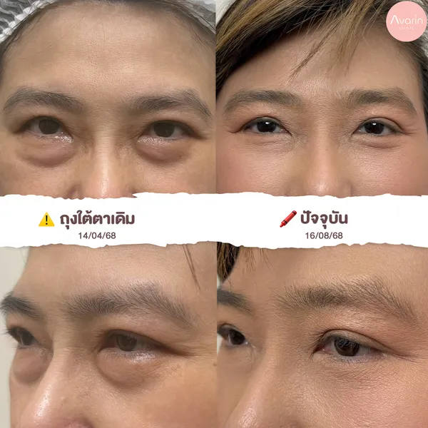 คุณเสา-2