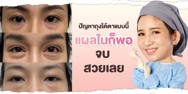แผลใน