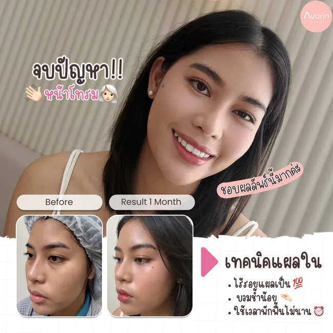 คุณเบียร์-1