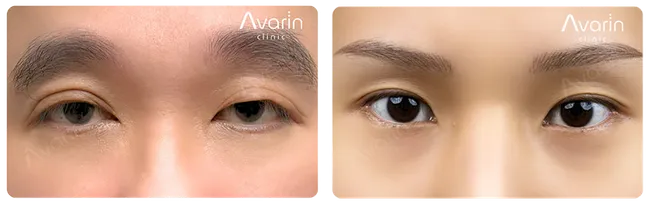 ชญ