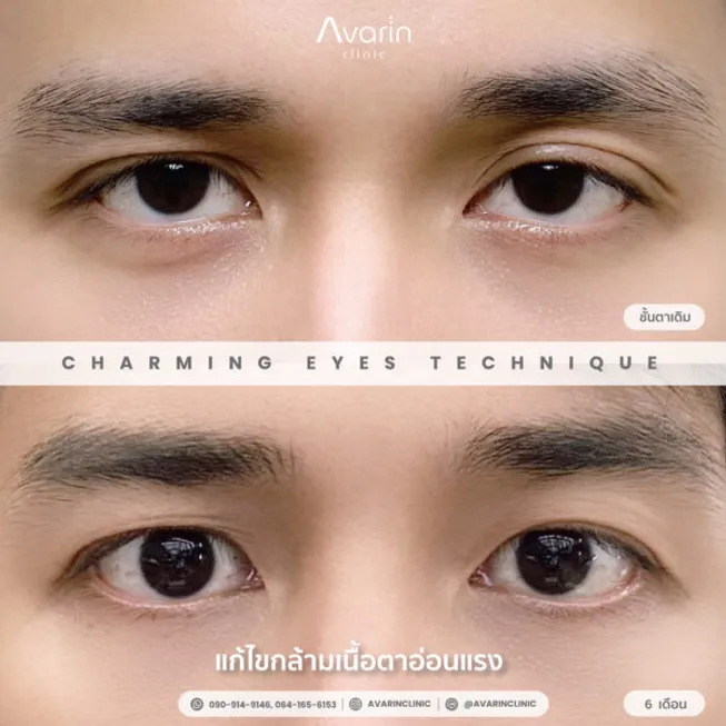 กัปตัน-6เดือน-600x600