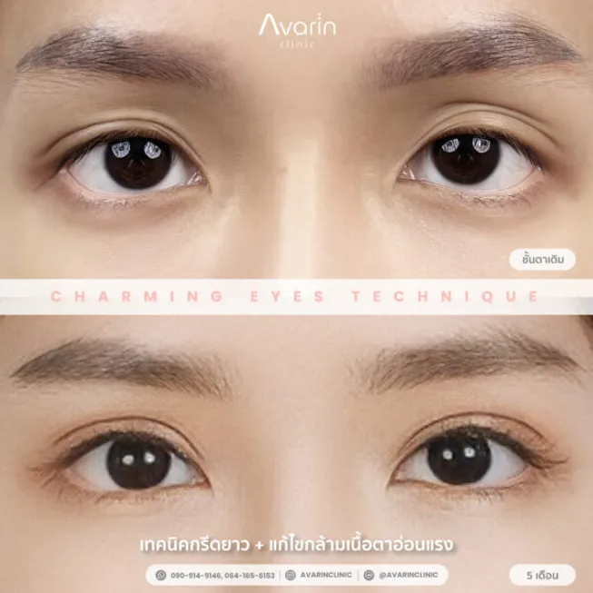 ฝน-5เดือน-1-600x600
