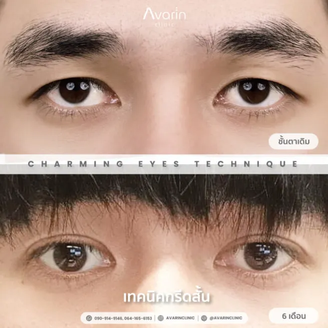 แบงค์-6เดือน-600x600