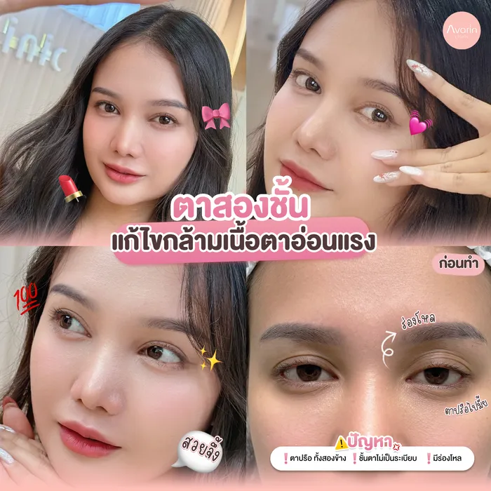 คะนิ้ง-4ช็อต0
