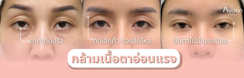 ก่อนทำ(1)